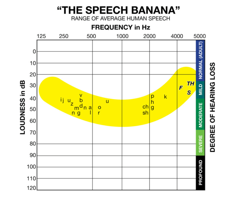 C919 Audiogram Template | Wiring Resources with Blank Audiogram